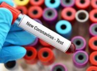 TÜRKİYE’YE GELEN HER YOLCUYA KORONA TESTİ