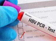 PCR TESTİ ZORUNLILUĞU 31 MAYIS’A KADAR UZATILDI