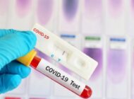 FRANSA, ÇİNLİ YOLCULARDAN COVİD TESTİ İSTEYECEK